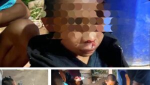 Tega,,, Anak Bawah Umur Babak Belur Diduga Dianiaya Pemilik Warung di Sandai, Polisi Turun Tangan